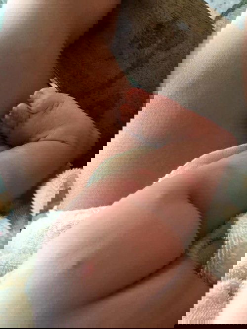 ลูก 5 เดือนเป็นผื่นแดง ยิ่งทายายิ่งเพิ่ม ยิ่งคัน ทำไงดีคะ