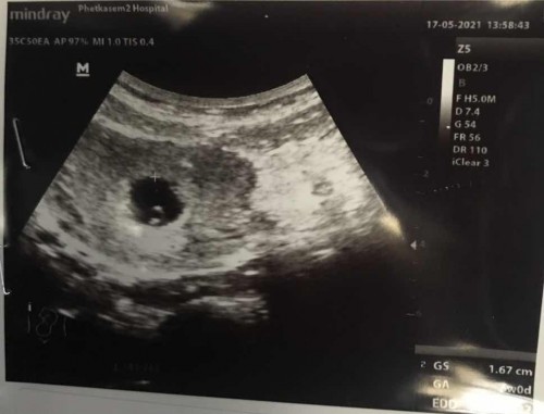 6wค่ะเห็นแต่ไข่แดง