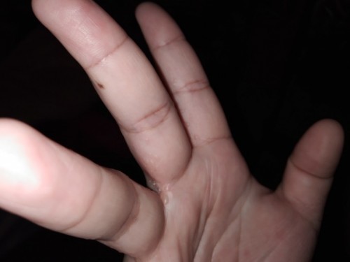 Butlig butlig po sa kamay