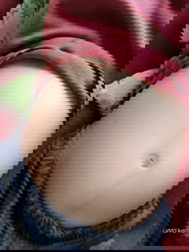 ท้องแข็ง แล้วมีอาการปวดร่วมด้วย