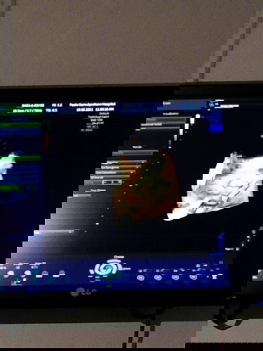 37+2weekแล้วค่ะ แม่ๆเริ่มเตรียมจัดกระเป๋าตอนไหนคะ