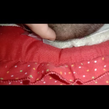 Benjolan Lunak di tengah kepala mohon Dijawab