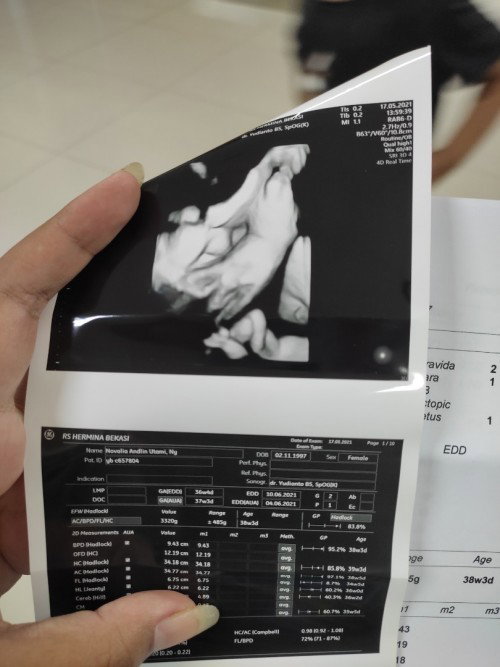 BB Bayi besar