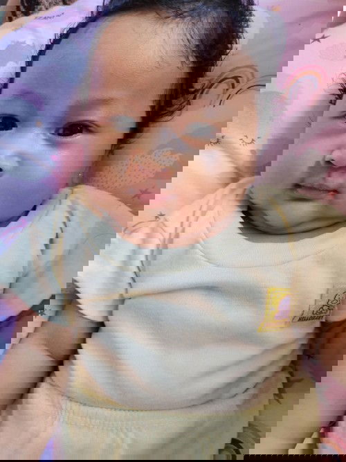 Baby lahir Sesar mempengaruhi pernapasan kah ?