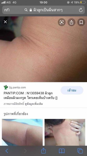 เกี่ยวมั้ยคะที่ใช้น้ำปะปาอาบให้ลูก