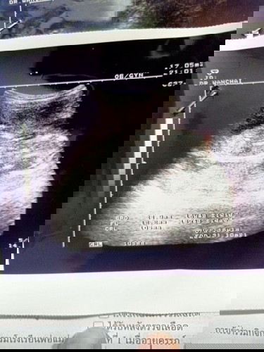 สอบถามคุณแม่หน่อยจ้า