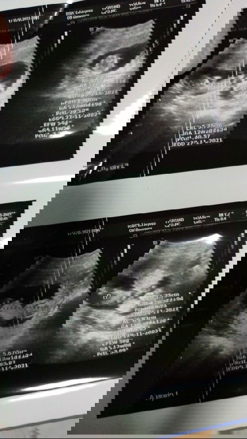 Mau curhat doang ni bund