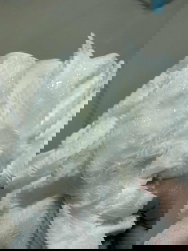 มูกแบบนี้ คืออะไรคะ เป็นอันตรายไหมคะ