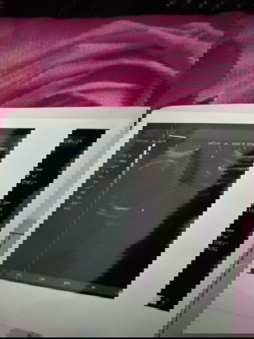 Mau tanya bunda aku masih bingung bacanya