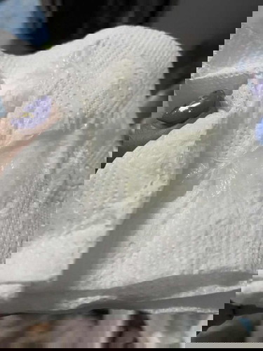 ใช่เจ็บเตือนไหมค่ะ