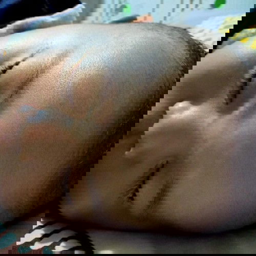 Putih" pd kening bayi tapi bukan panu