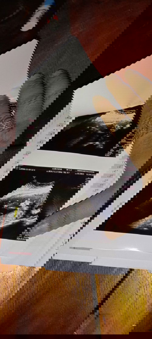 ผมเป็นคุณพ่อมือใหม่ ช่วยแนะนำหน่อยครับ อีก2เดือนก็คลอดแล้ว