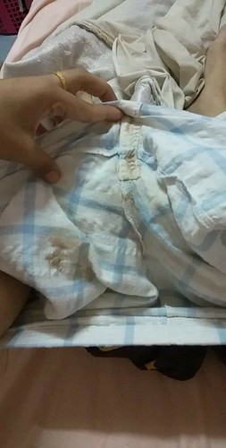 ฝังยาคุมแล้วท้องมั้ย