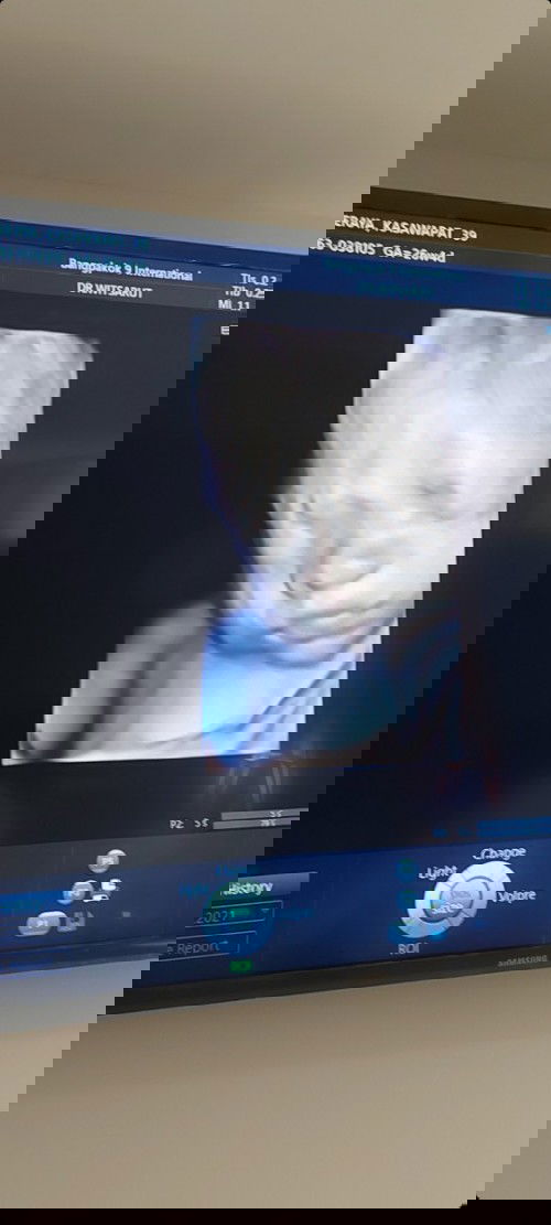 ลูกกลับหัวตั้งแต่ 21w เห็นเค้าว่าเด็กจะหมุนไปทั่ว อาจจะกลับขึ้นอีก เพิ่งไปซาวด์มาล่าสุด 27w