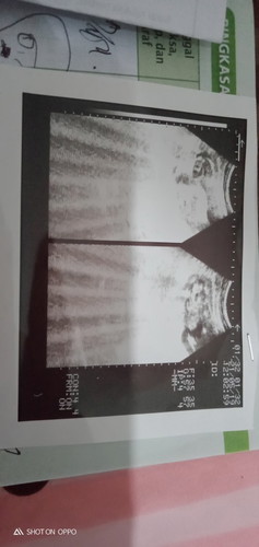 Cetak USG tanpa keterangan