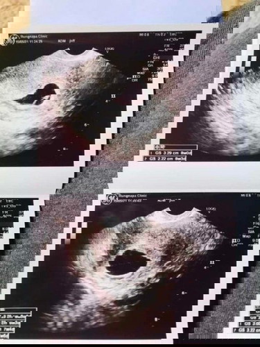 ขอสอบถามแม่ๆ หน่อยค่ะ