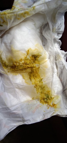 Sawan o taon (poop ni baby)