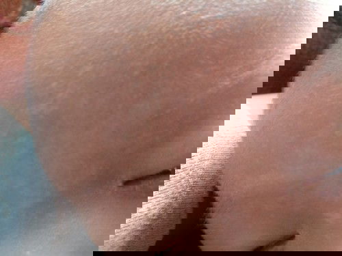 bercak putih pada wajah si bayik