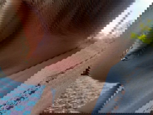 Cá mom cho e hỏi bé nhà e 4m26d bị z là bị như nào ạ .. Ngủ đêm sáng thấy z ạ