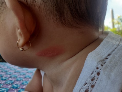 Cá mom cho e hỏi bé nhà e 4m26d bị z là bị như nào ạ .. Ngủ đêm sáng thấy z ạ