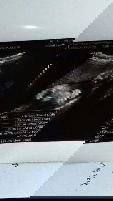 คือรูปอะไร