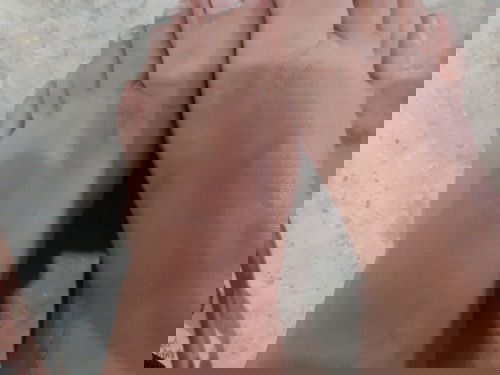 Hello po mommies..
Natural lang po ba ang pagmamanas ng paa? 19weeks pregnant po. Thank you po