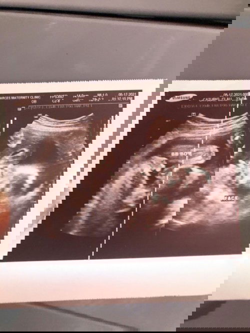 #firstbaby#pregnancy#babyboy💙