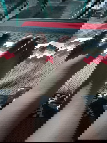 Normal lang po ba magmanas na yung 5 months preggy?