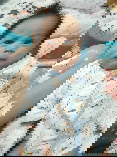 ลูกเป็นผื่นที่หน้า