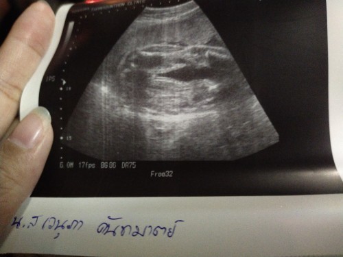 สอบถามแม่ๆที่เคยมีลูก