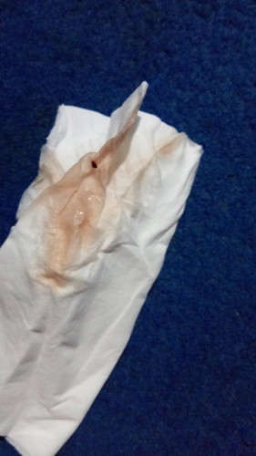 Keluar bercak darah kecoklatan