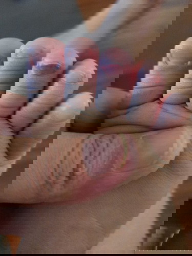 จะเป็นไรไหมค่ะ