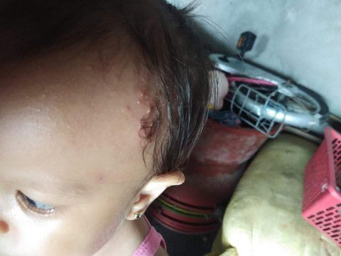 Ano pong gamot para dto