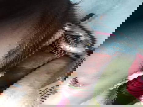 Ano pong gamot para dto