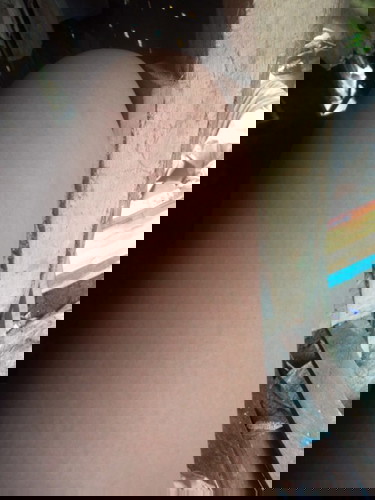 IT IS PUPPP RASHES??