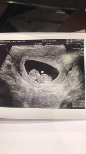 รบกวนแม่ๆช่วยคิดชื่อเจ้าตัวเล็กหน่อยนะคะ อยากได้ บอใบไม้ค่ะ ชื่อเล่นของลูก