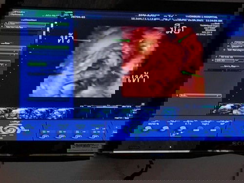 แม่ๆจ๋า ช่วยคิดชื่อเล่นลูกให้หน่อยจ้าคิดไม่ตก 🤔🤔