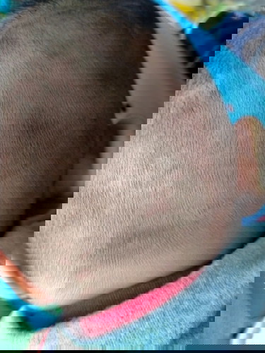 ใช่ปานไหมคะ