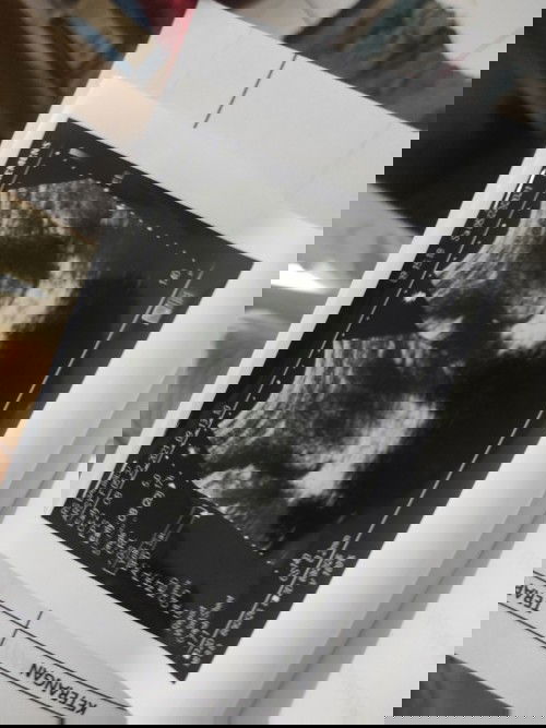 Hsil usg dan cara baca hasil usg