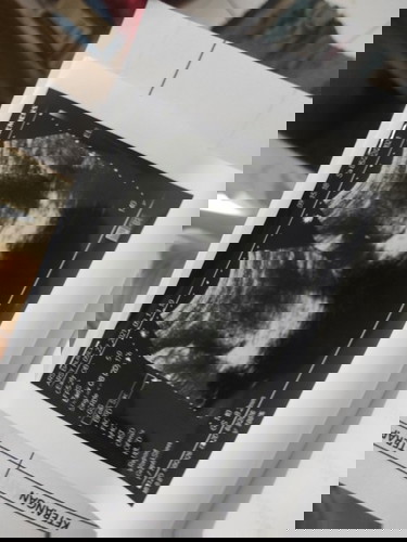 Hsil usg dan cara baca hasil usg