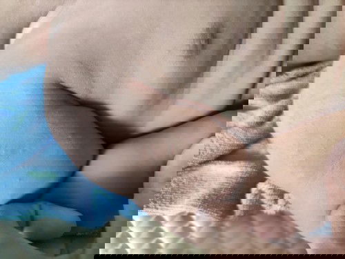 Bintik merah di badan dan muka