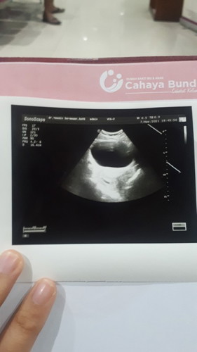 Mau tanya perihal usg,skrg usia 7w 5h