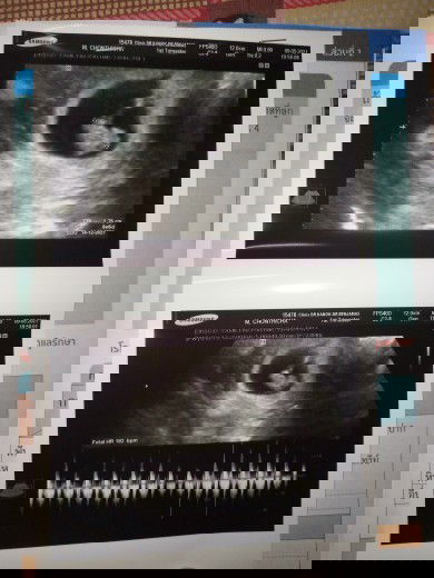 วันนี้ที่รอคอยมา2ปี👶