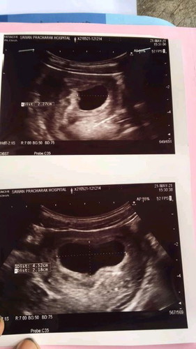 มีความหวังจะเจอน้องไหมค่ะ