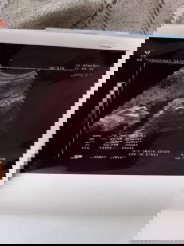 แม่ๆช่วยตั้งชื่อให้น้องหน่อยคับ 🥰