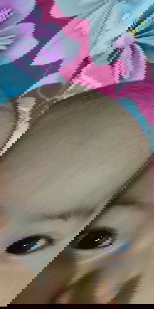 Ubun ubun bayi 4 bulan.