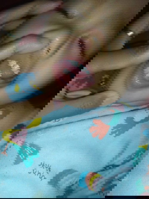 15bulan belum tumbuh gigi lagi