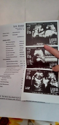 28weeks 2days preg.
2nd baby
1st baby boy 5 yrs old