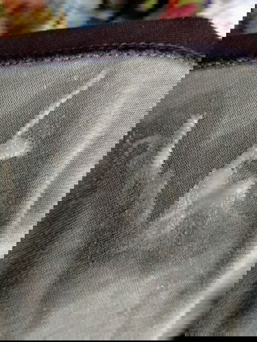 Is it normal discharge ?