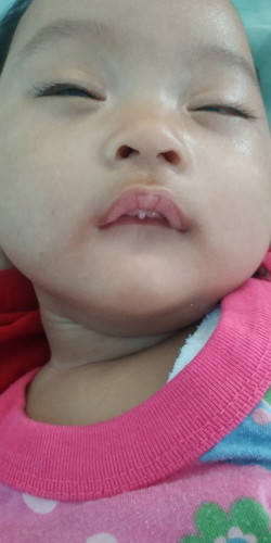 Gusi bayi 3 bulan
